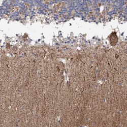 Invitrogen PARD3 Polyclonal Antibody 100 &mu;L; Unconjugated:Antibodies,