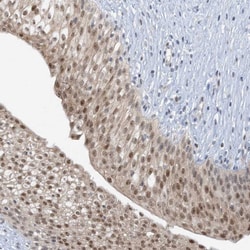 UBE2E1 Polyclonal Antibody:Antibodies, Polyclonal