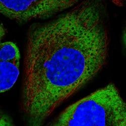 Invitrogen RPL26 Polyclonal Antibody 100 &mu;L; Unconjugated:Antibodies,