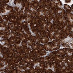 Invitrogen RPL26 Polyclonal Antibody 100 &mu;L; Unconjugated:Antibodies,