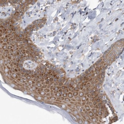 Invitrogen RPL26 Polyclonal Antibody 100 &mu;L; Unconjugated:Antibodies,