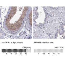 Invitrogen MAGEB4 Polyclonal Antibody 100 &mu;L; Unconjugated:Antibodies,