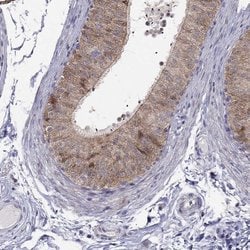 Invitrogen MAGEB4 Polyclonal Antibody 100 &mu;L; Unconjugated:Antibodies,