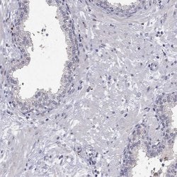 Invitrogen MAGEB4 Polyclonal Antibody 100 &mu;L; Unconjugated:Antibodies,
