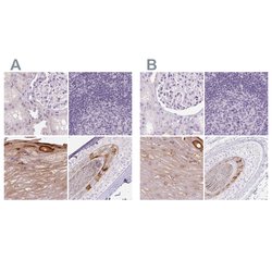 Invitrogen RPTN Polyclonal Antibody 100 &mu;L; Unconjugated:Antibodies,