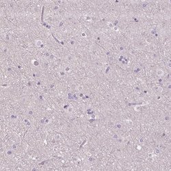 Invitrogen RPTN Polyclonal Antibody 100 &mu;L; Unconjugated:Antibodies,