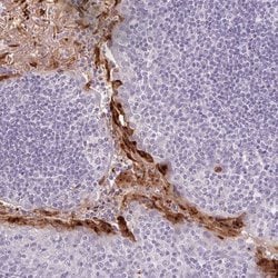 Invitrogen RPTN Polyclonal Antibody 100 &mu;L; Unconjugated:Antibodies,