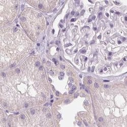 Invitrogen RPTN Polyclonal Antibody 100 &mu;L; Unconjugated:Antibodies,