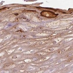 Invitrogen RPTN Polyclonal Antibody 100 &mu;L; Unconjugated:Antibodies,