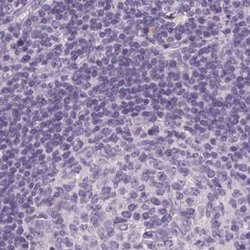 Invitrogen RPTN Polyclonal Antibody 100 &mu;L; Unconjugated:Antibodies,