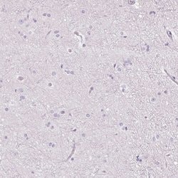 RPTN Polyclonal Antibody:Anticorps, Polyclonal