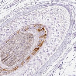 RPTN Polyclonal Antibody:Anticorps, Polyclonal