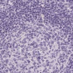 RPTN Polyclonal Antibody:Anticorps, Polyclonal