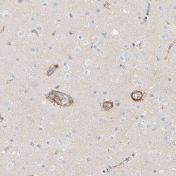 Invitrogen KCNH5 Polyclonal Antibody 100 &mu;L; Unconjugated:Antibodies,