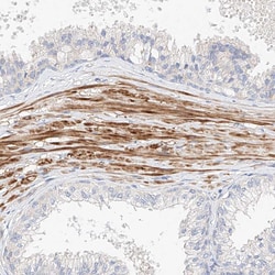 Invitrogen KCNH5 Polyclonal Antibody 100 &mu;L; Unconjugated:Antibodies,