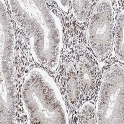 Invitrogen KLF7 Polyclonal Antibody 100 &mu;L; Unconjugated:Antibodies,