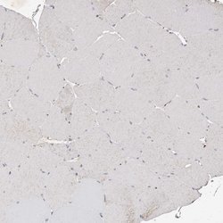Invitrogen KLF7 Polyclonal Antibody 100 &mu;L; Unconjugated:Antibodies,