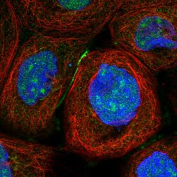 TSR2 Polyclonal Antibody 100 &mu;L | Buy Online | Thermo Scientific | Fisher Scientific