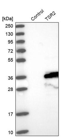 TSR2 Polyclonal Antibody 100 &mu;L | Buy Online | Thermo Scientific | Fisher Scientific