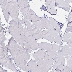 MARCKSL1 Polyclonal Antibody:Antibodies, Polyclonal