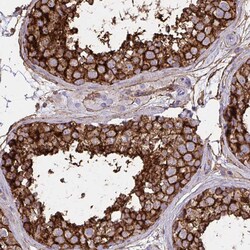 MARCKSL1 Polyclonal Antibody:Antibodies, Polyclonal