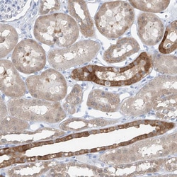 Invitrogen UFL1 Polyclonal Antibody 100 &mu;L; Unconjugated:Antibodies,