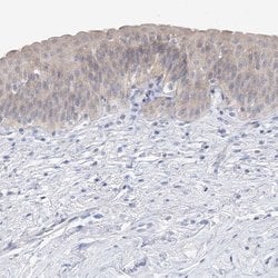 Invitrogen UFL1 Polyclonal Antibody 100 &mu;L; Unconjugated:Antibodies,