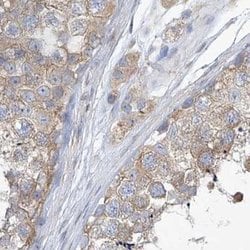 Invitrogen UFL1 Polyclonal Antibody 100 &mu;L; Unconjugated:Antibodies,
