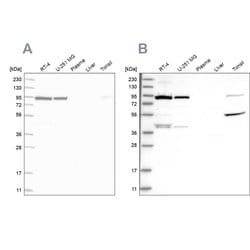 Invitrogen UFL1 Polyclonal Antibody 100 &mu;L; Unconjugated:Antibodies,