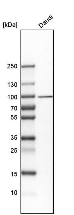 Invitrogen UFL1 Polyclonal Antibody 100 &mu;L; Unconjugated:Antibodies,