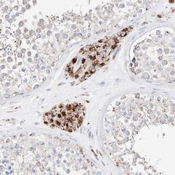Invitrogen C6orf62 Polyclonal Antibody 100 &mu;L; Unconjugated:Antibodies,
