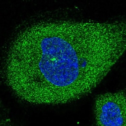 Invitrogen C6orf62 Polyclonal Antibody 100 &mu;L; Unconjugated:Antibodies,