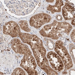 Invitrogen C6orf62 Polyclonal Antibody 100 &mu;L; Unconjugated:Antibodies,