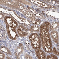 Invitrogen SRBD1 Polyclonal Antibody 100 &mu;L | Buy Online | Invitrogen&trade; | Fisher Scientific