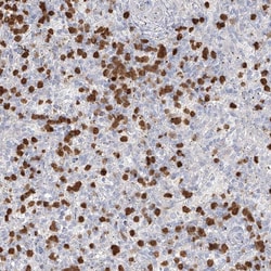 Invitrogen ZNF227 Polyclonal Antibody 100 &mu;L; Unconjugated:Antibodies,