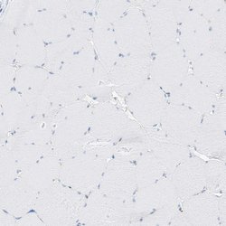 ITGA9, Polyclonal, Invitrogen 100&mu;L; Unconjugated:Antibodies, Polyclonal