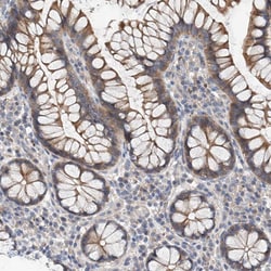 Invitrogen MAGEE2 Polyclonal Antibody 100 &mu;L; Unconjugated:Antibodies,
