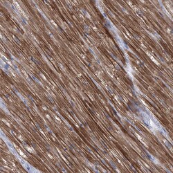 Invitrogen Sbk2 Polyclonal Antibody 100 &mu;L; Unconjugated:Antibodies,