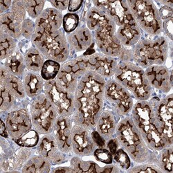 Invitrogen Sbk2 Polyclonal Antibody 100 &mu;L; Unconjugated:Antibodies,