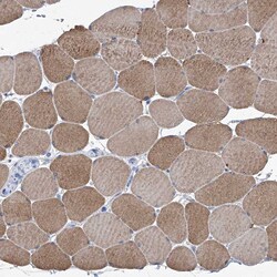 Invitrogen Sbk2 Polyclonal Antibody 100 &mu;L; Unconjugated:Antibodies,