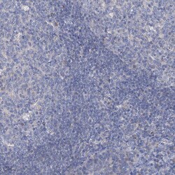 Invitrogen Sbk2 Polyclonal Antibody 100 &mu;L; Unconjugated:Antibodies,
