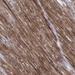 Invitrogen Sbk2 Polyclonal Antibody 100 &mu;L; Unconjugated:Antibodies,