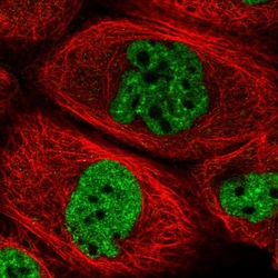 Invitrogen ZFP14 Polyclonal Antibody 100 &mu;L; Unconjugated:Antibodies,
