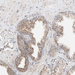 Invitrogen YIPF7 Polyclonal Antibody 100 &mu;L; Unconjugated:Antibodies,