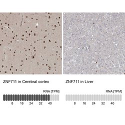Invitrogen ZNF711 Polyclonal Antibody 100 &mu;L; Unconjugated:Antibodies,