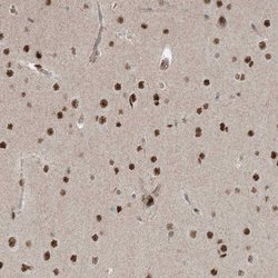 Invitrogen ZNF711 Polyclonal Antibody 100 &mu;L; Unconjugated:Antibodies,
