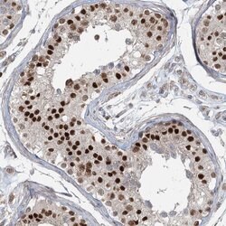 Invitrogen ZNF711 Polyclonal Antibody 100 &mu;L; Unconjugated:Antibodies,