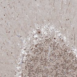 Invitrogen ZNF711 Polyclonal Antibody 100 &mu;L; Unconjugated:Antibodies,
