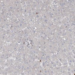 Invitrogen ZNF711 Polyclonal Antibody 100 &mu;L; Unconjugated:Antibodies,