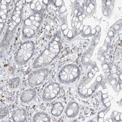 Invitrogen SAMD15 Polyclonal Antibody 100 &mu;L; Unconjugated:Antibodies,
